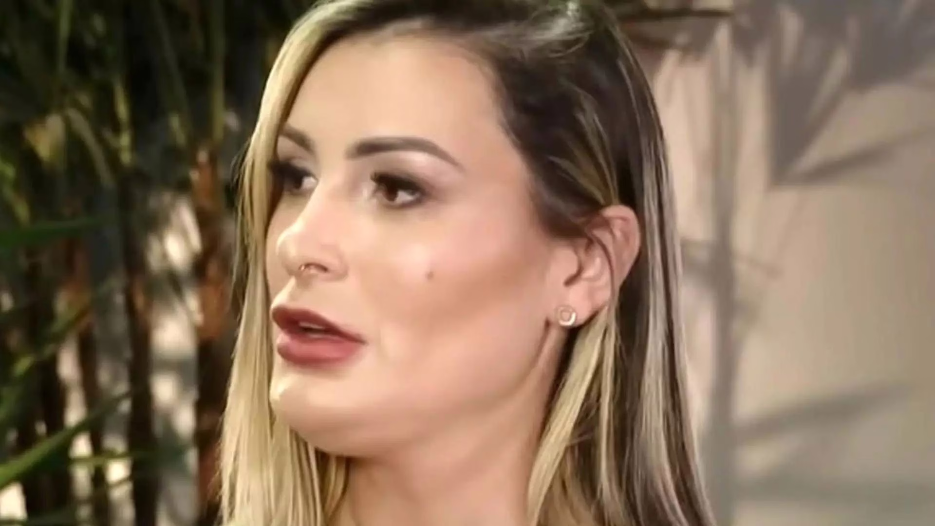 Após revelar medo de ficar cega, Andressa Urach conta o que médico falou