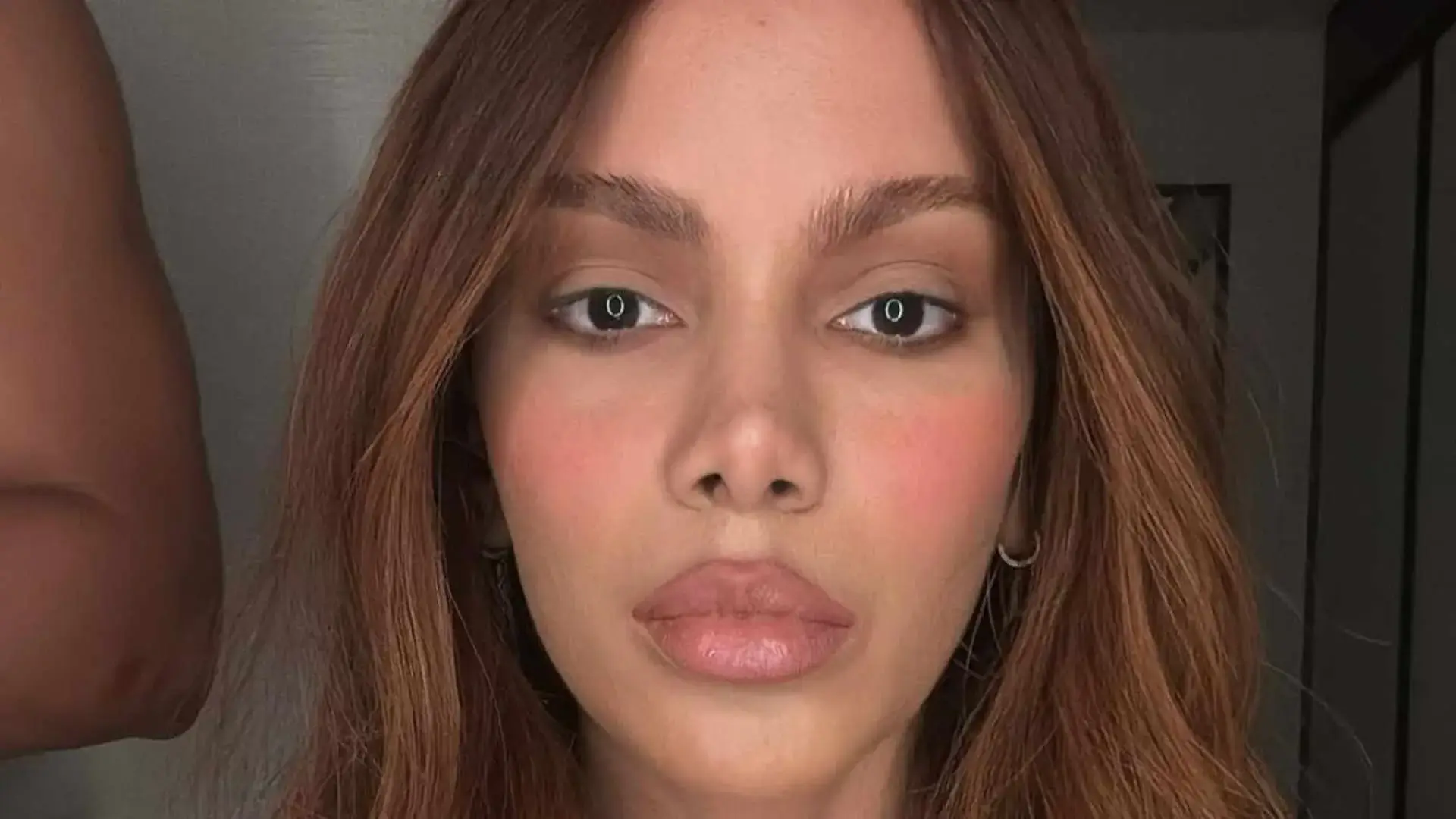 Anitta rebate boatos sobre aparência e explica afastamento das redes sociais