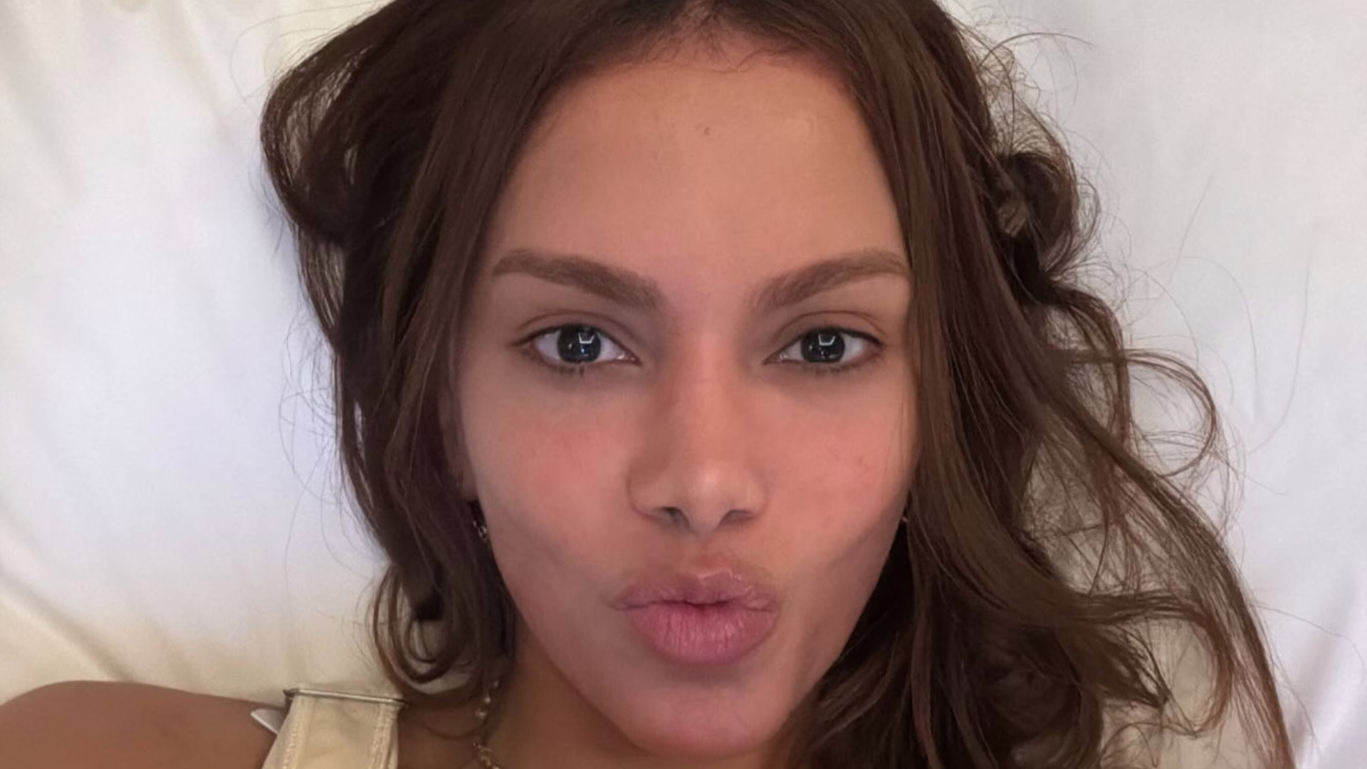 Anitta exibe ‘novo rosto’ após procedimentos estéticos, mas limita comentários