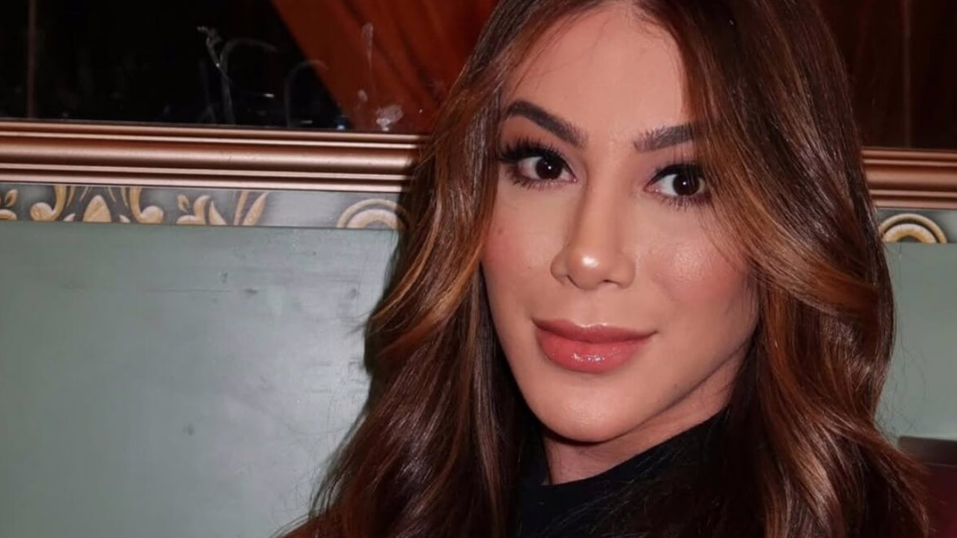 Apoline mostra cirurgia a amigos e gera muitos elogios