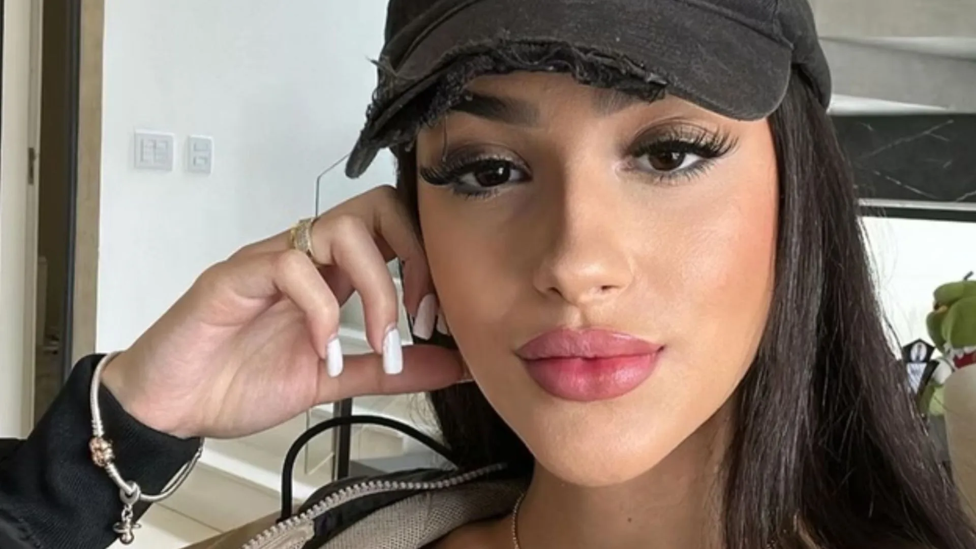 Bia Miranda mostra ferimento no corpo após acidente de carro