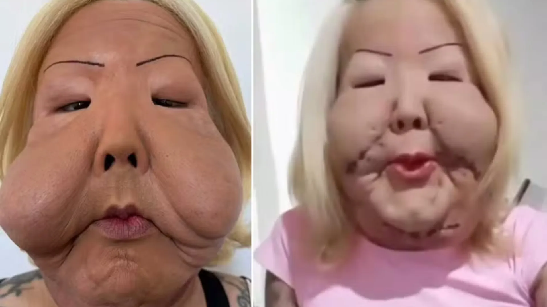 Juju do Pix reaparece após primeira etapa de reconstrução facial