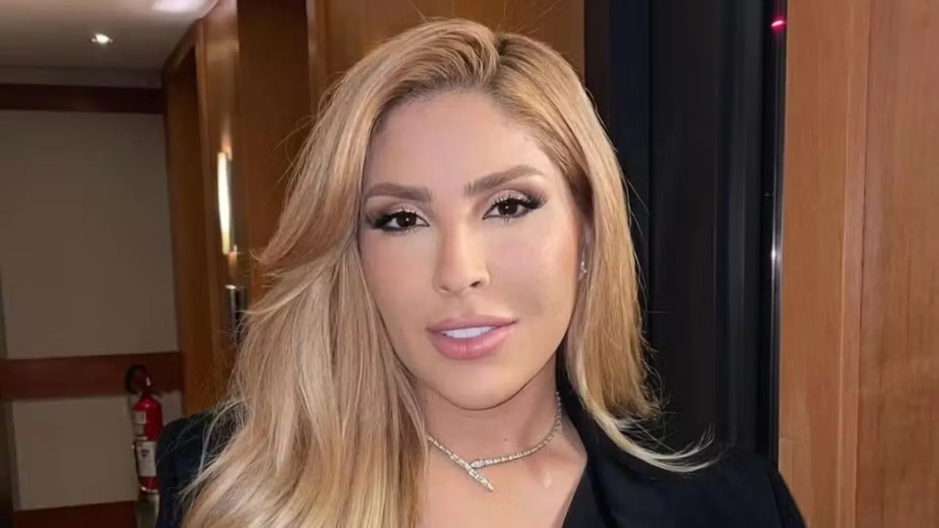 Manu Batidão inicia 2026 com procedimento estético e esclarece: “Zero preenchimento”