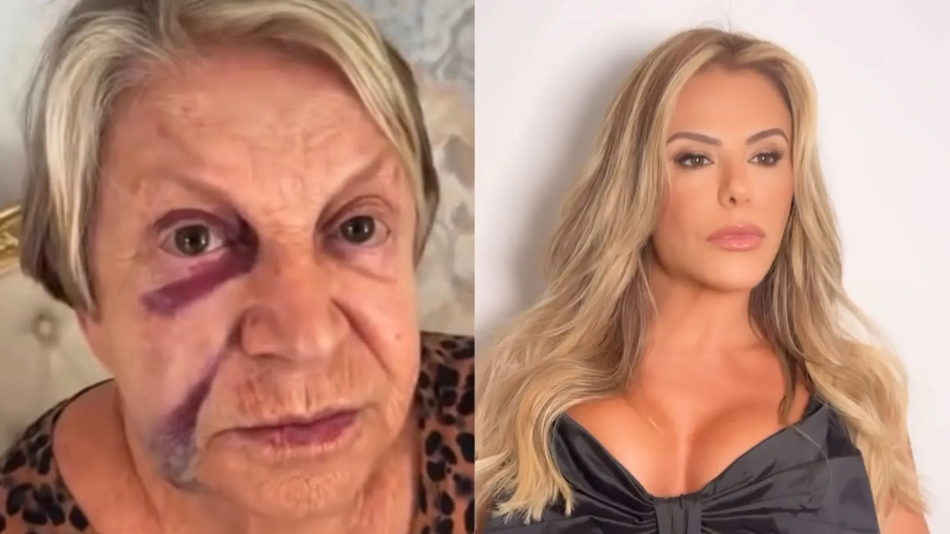 Poliana passa por susto após queda da mãe, que aparece com olho roxo