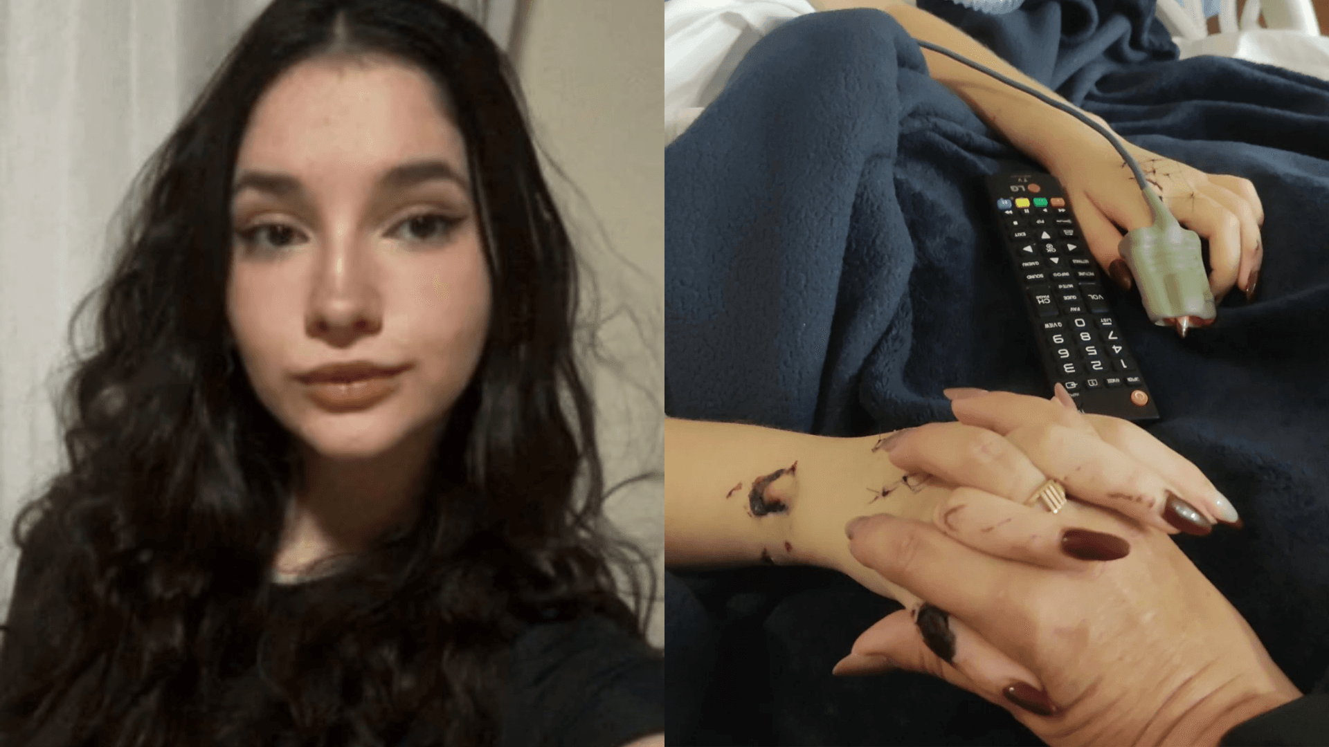 Jovem esfaqueada 30 vezes após recusar namoro sai do coma e apresenta melhora