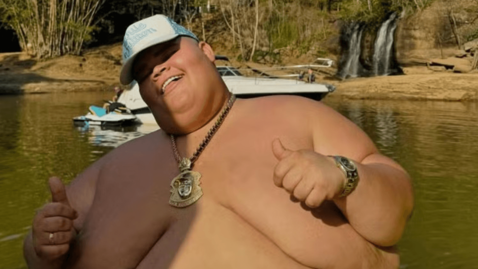 Gordão da XJ atualiza estado de saúde após cirurgia e relata infecção no pós-operatório