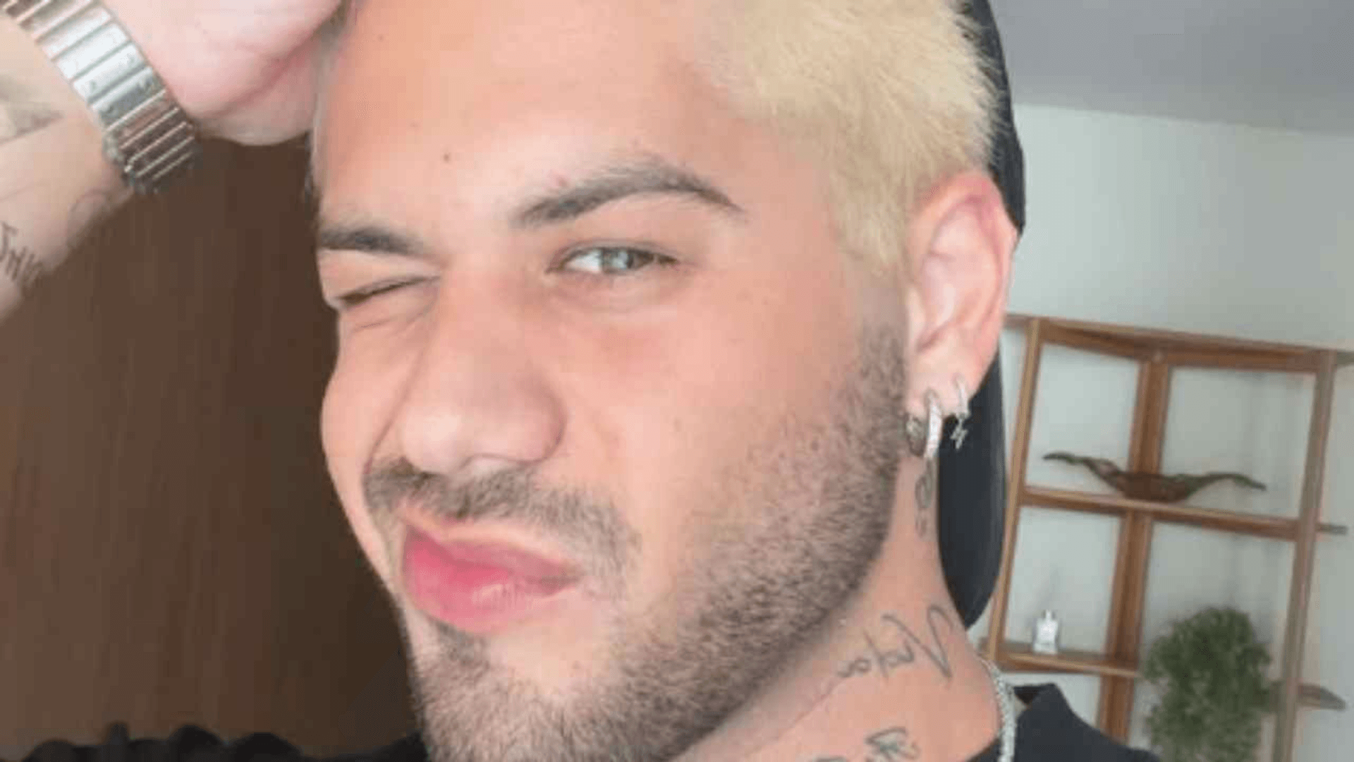 Zé Felipe revela tratamento para corrigir rasgo no lóbulo da orelha