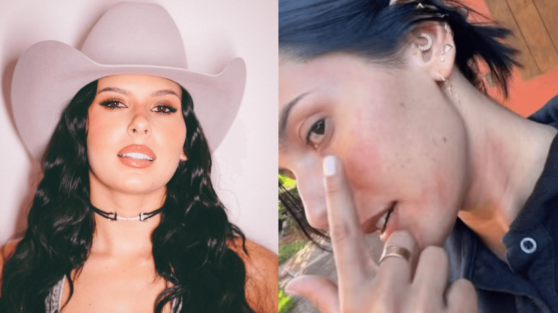 Ana Castela brinca após reação alérgica: “Dá pra beijar mais um gatinho”