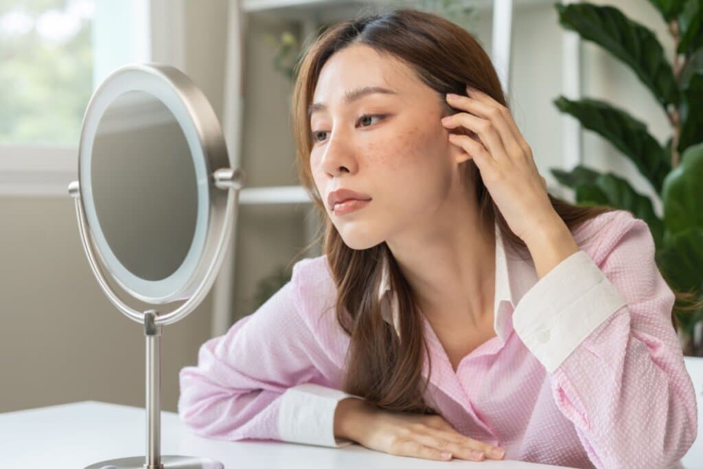 Avaliação dermatológica: veja por que ela é importante antes de um tratamento estético
