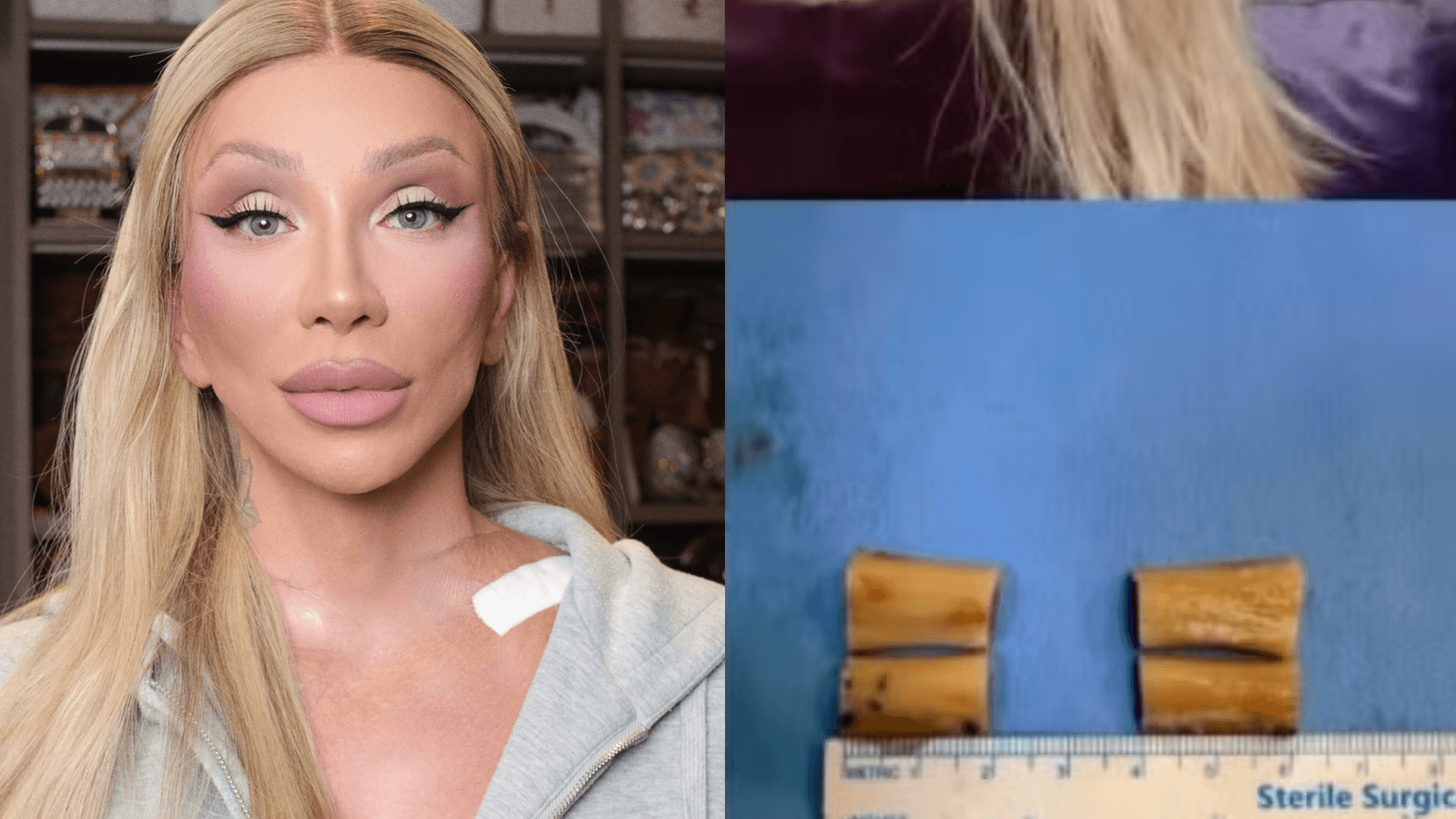 Maya Massafera mostra resultado da cirurgia para reduzir os ombros e exibe ossos removidos