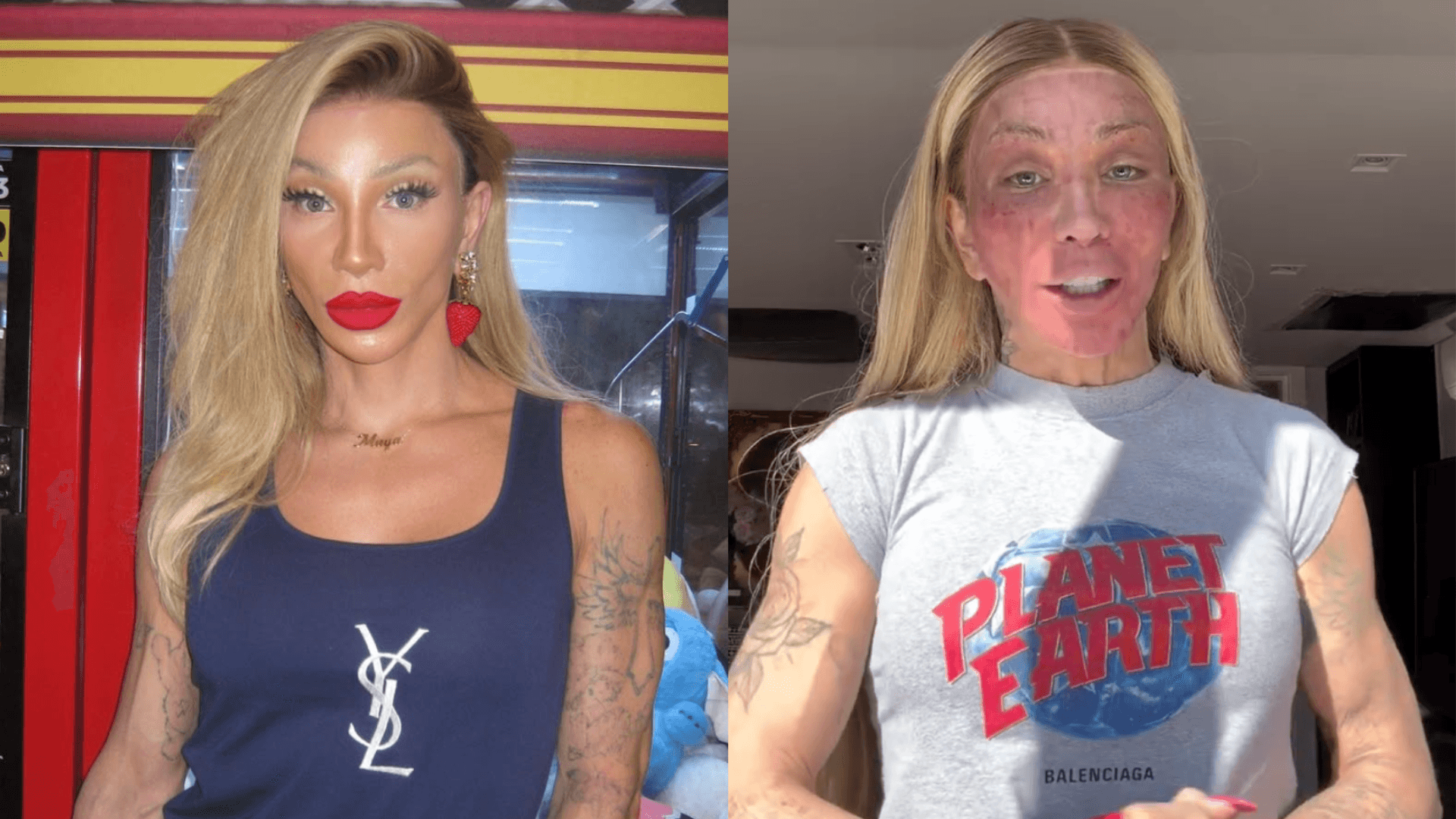 Maya Massafera mostra efeito de peeling no rosto: “Nunca inchou tanto”