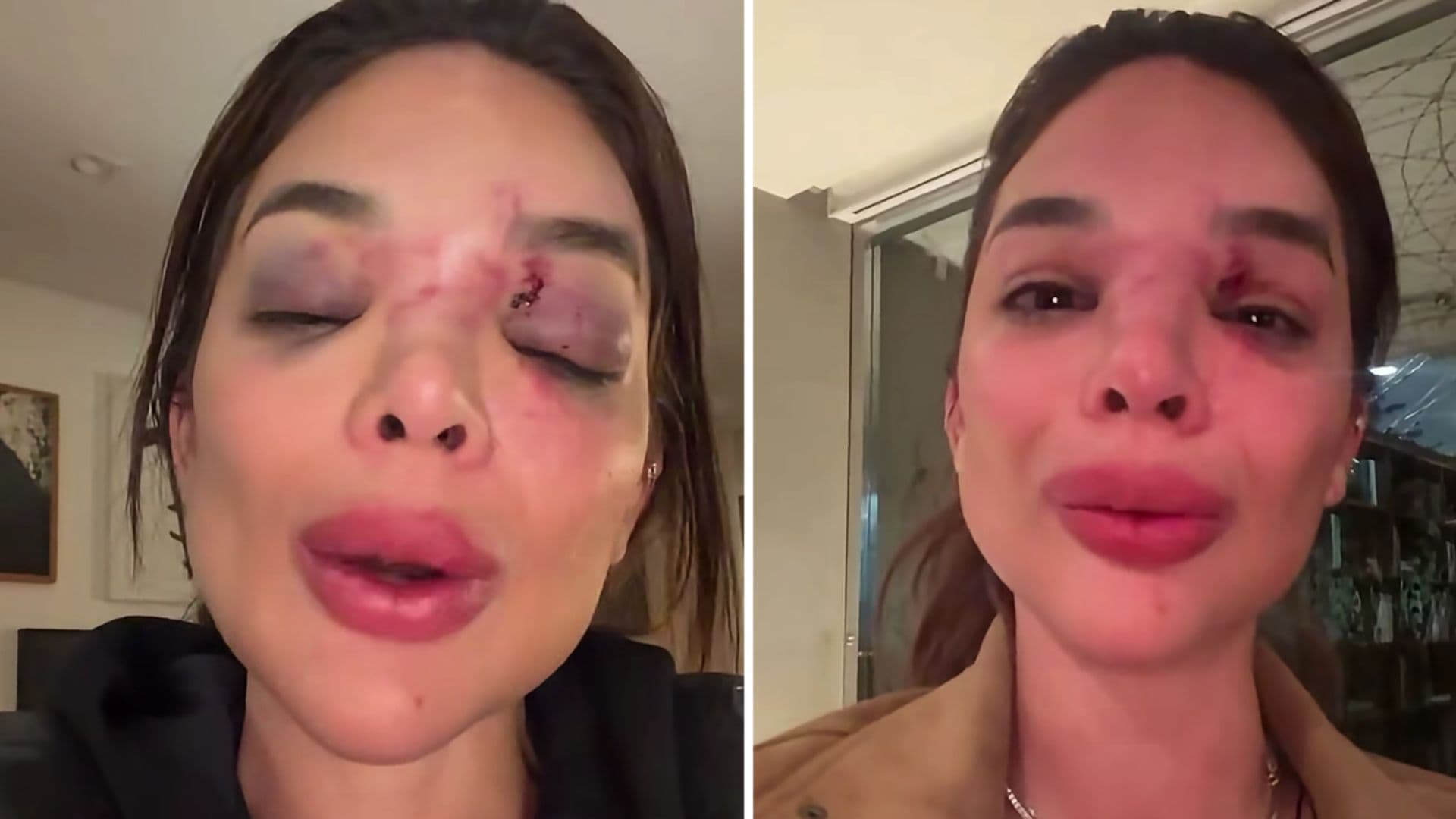 Fantástico exibe câmera de segurança flagrando agressão a dentista por empresário da Faria Lima: “Tentou me m*tar”