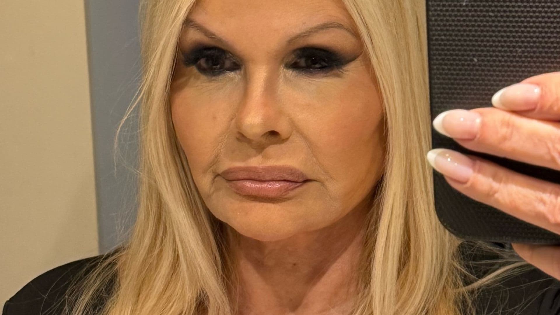 Monique Evans mostra resultado do rosto cinco dias após procedimento